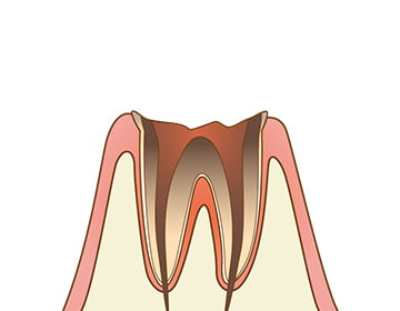 C4 イメージ画像