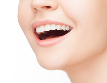 痛みの少ないホワイトニング イメージ画像